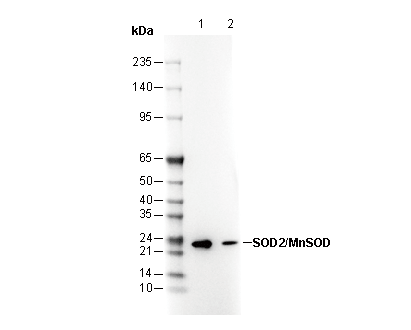Acetyl-SOD2/MnSOD (Lys68) Antibody