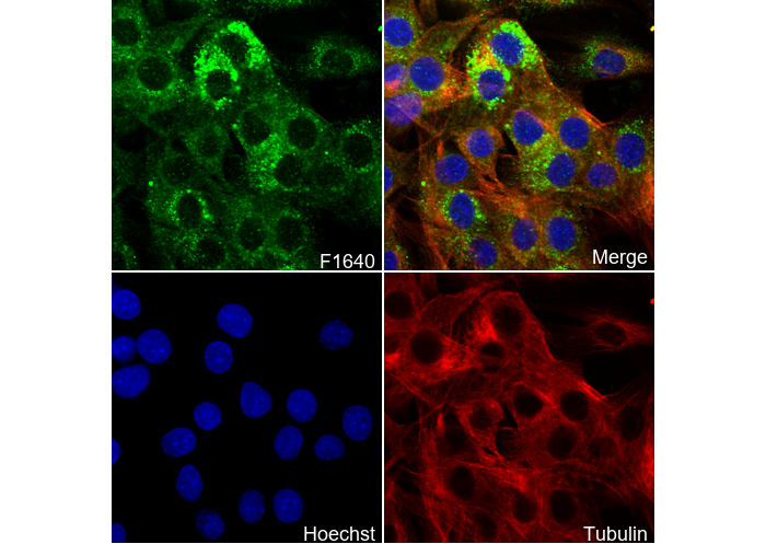 Dysferlin Antibody