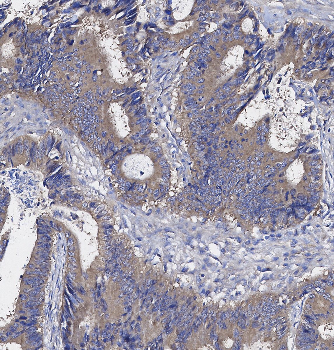 Peroxiredoxin 2/PRP Antibody