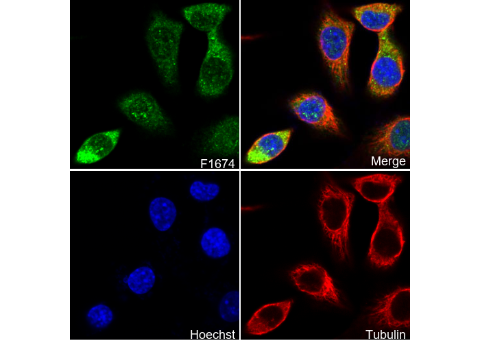 Phospho-eIF4E (Ser209) Antibody