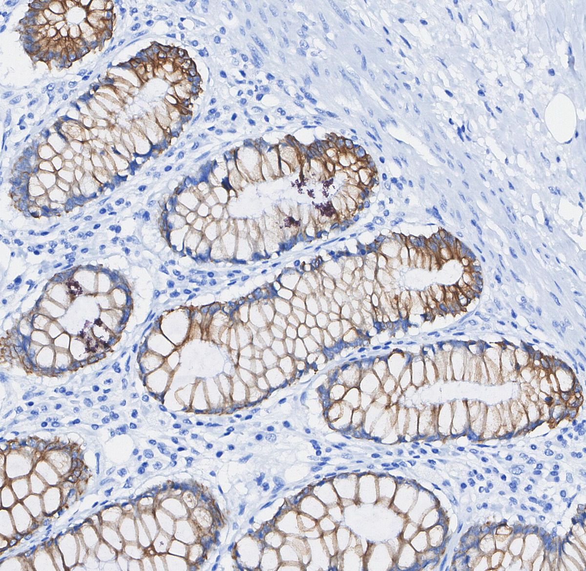 β IV Tubulin Antibody