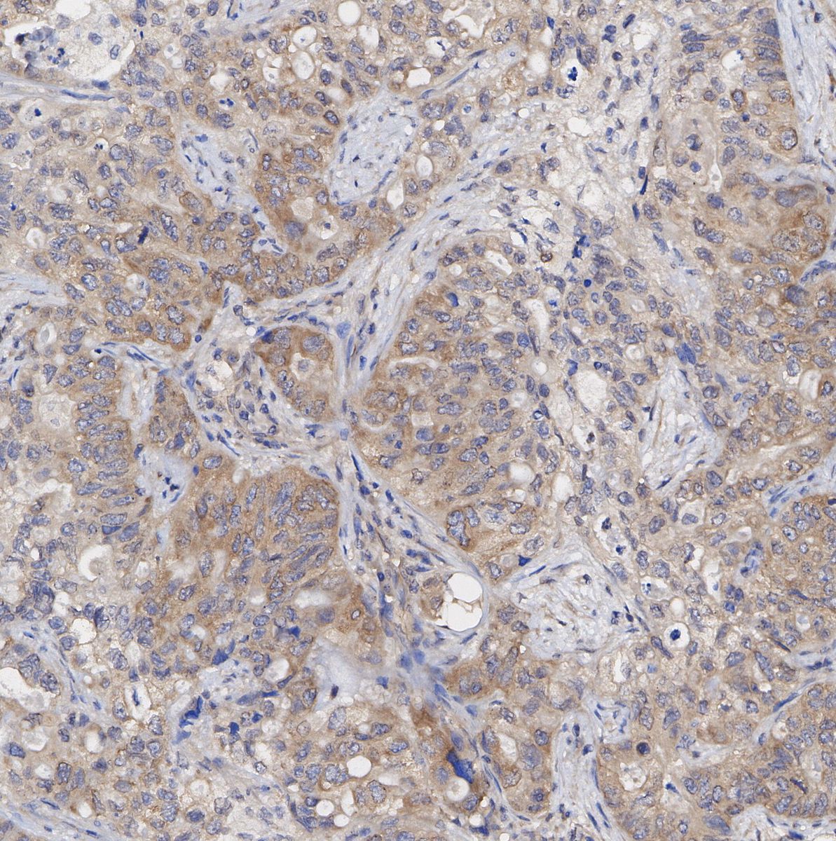 Syntenin Antibody