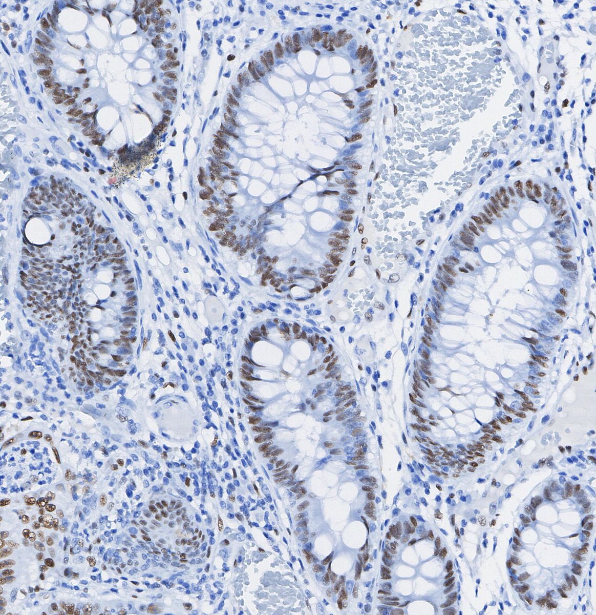 Topoisomerase I Antibody