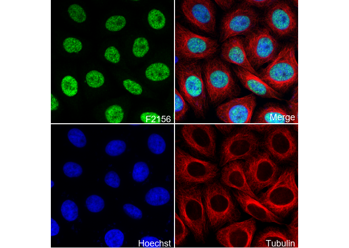 FOXA1 Antibody