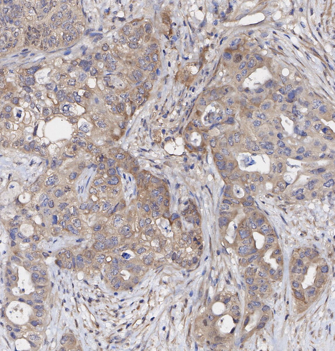 TRIM25/EFP Antibody