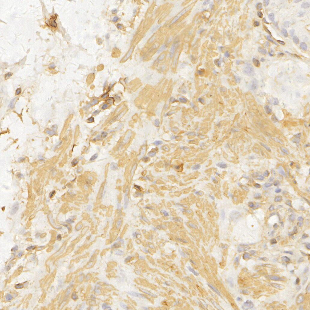 α smooth muscle Actin (acetyl Glu3) + Actin γ2 (acetyl Glu3) Antibody