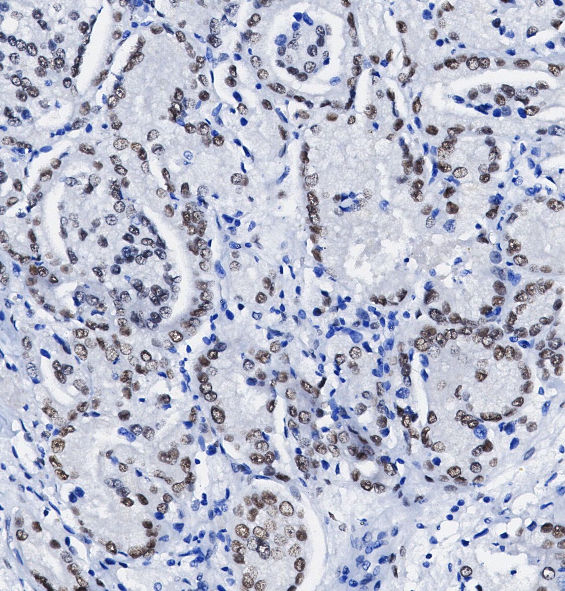 hnRNP C1 + C2/HNRNPC Antibody