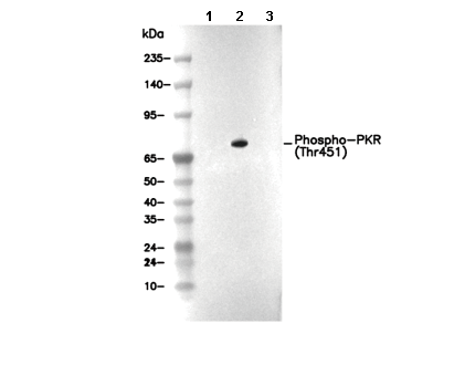 Phospho-PKR (Thr451) Antibody