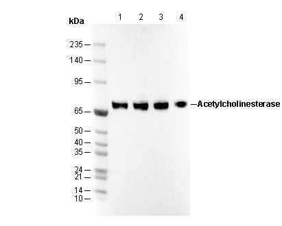 Acetylcholinesterase Antibody