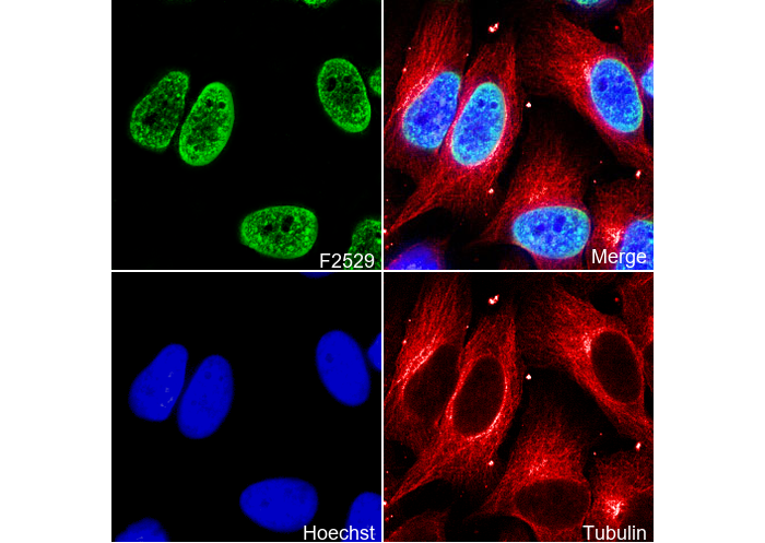 Histone H3 (tri methyl Lys27) Antibody