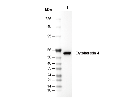 Cytokeratin 4 Antibody