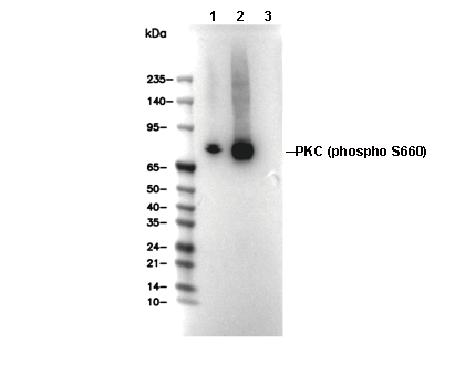 Phospho-PKC (Ser660) Antibody
