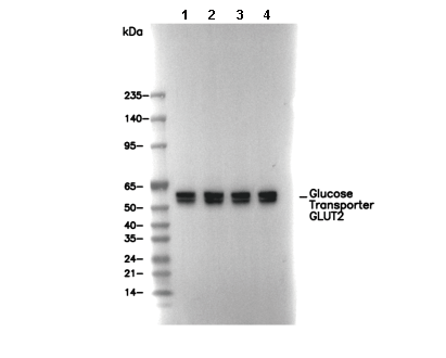 Glucose Transporter GLUT2 Antibody