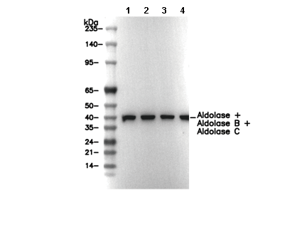 Aldolase + Aldolase B + Aldolase C Antibody