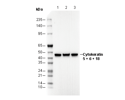Cytokeratin 5 + 6 + 18 Antibody