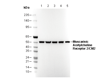 Muscarinic Acetylcholine Receptor 2/CM2 Antibody