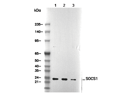 SOCS1 Antibody