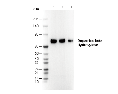 Dopamine β Hydroxylase Antibody