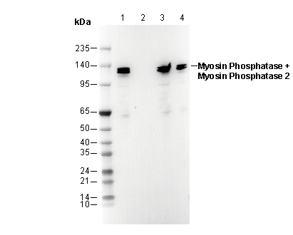 Myosin Phosphatase + Myosin Phosphatase 2 Antibody