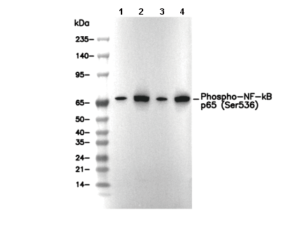 Phospho-NF-κB p65 (Ser536) Antibody