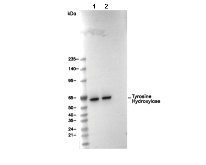 Tyrosine Hydroxylase Antibody