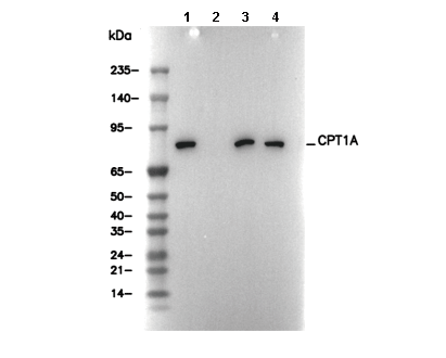 CPT1A Antibody