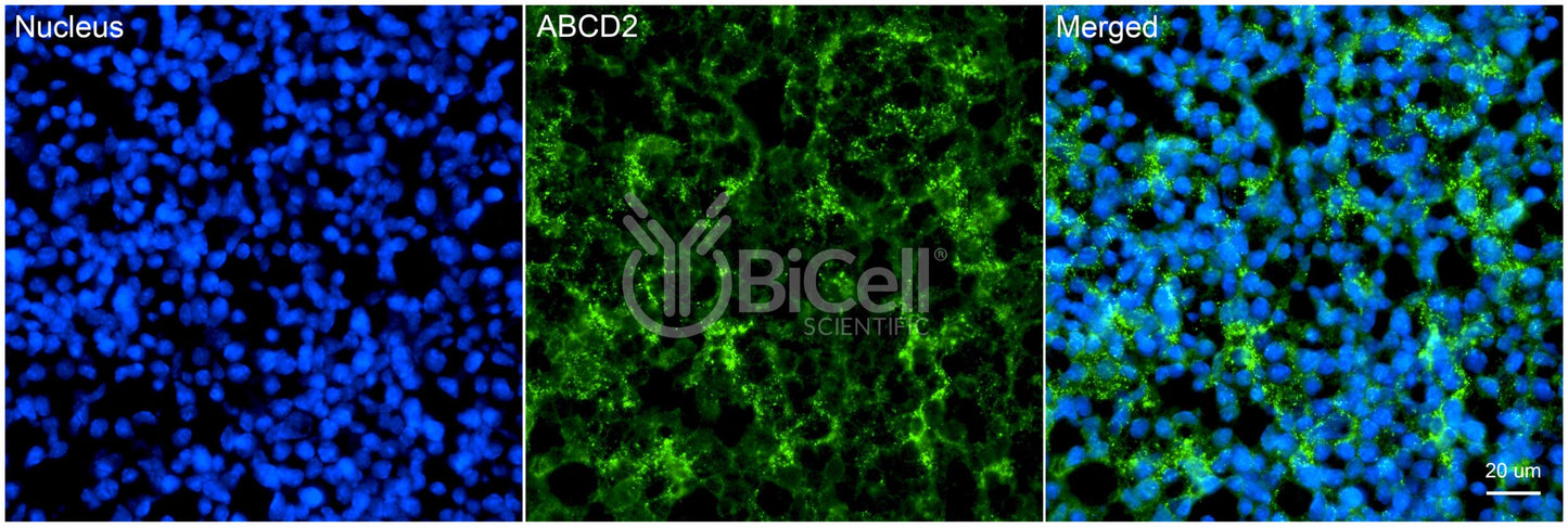 ABCD2 Antibody - FFPE Validated