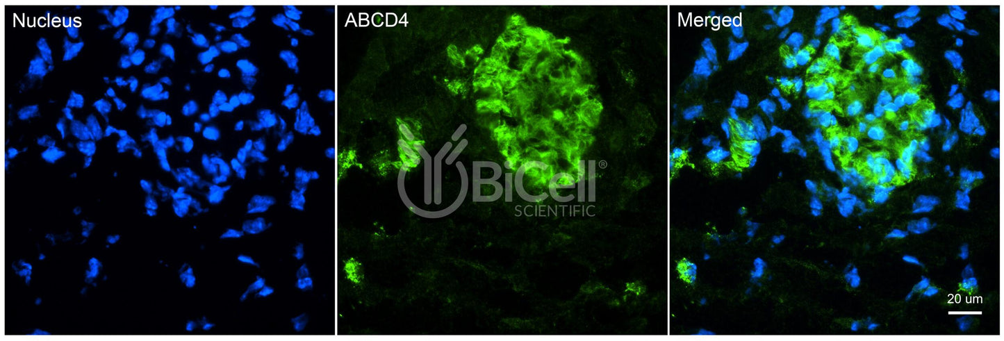 ABCD4 Antibody