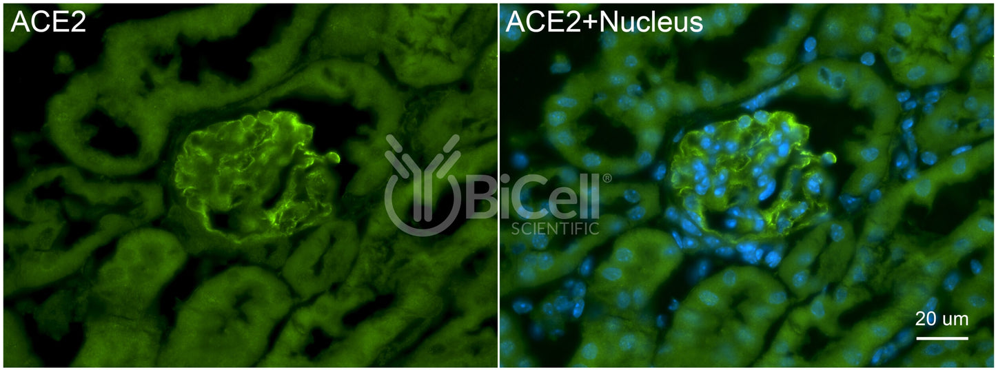 ACE2 Antibody - FFPE Validated