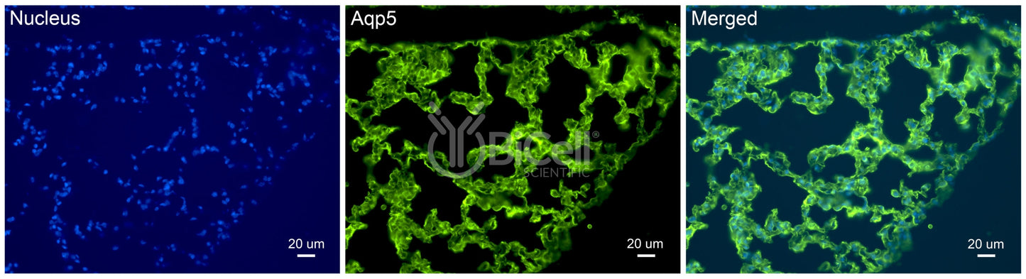Aquaporin-5 (AQP5) Antibody - FFPE Validated