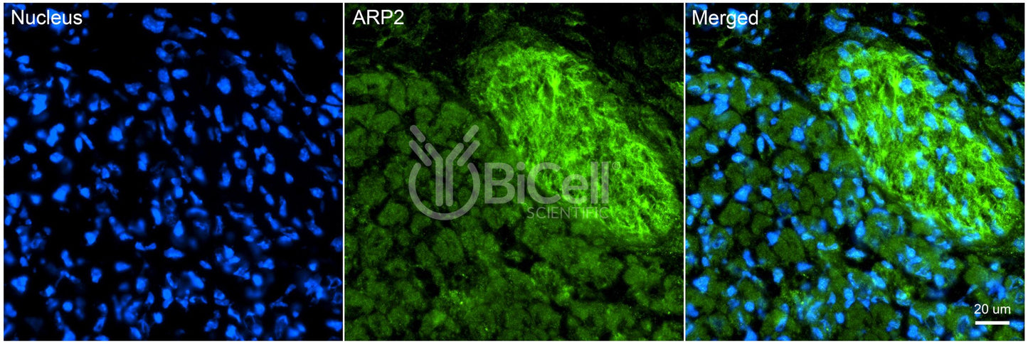 ACTR2 (ARP2) Antibody - FFPE Validated