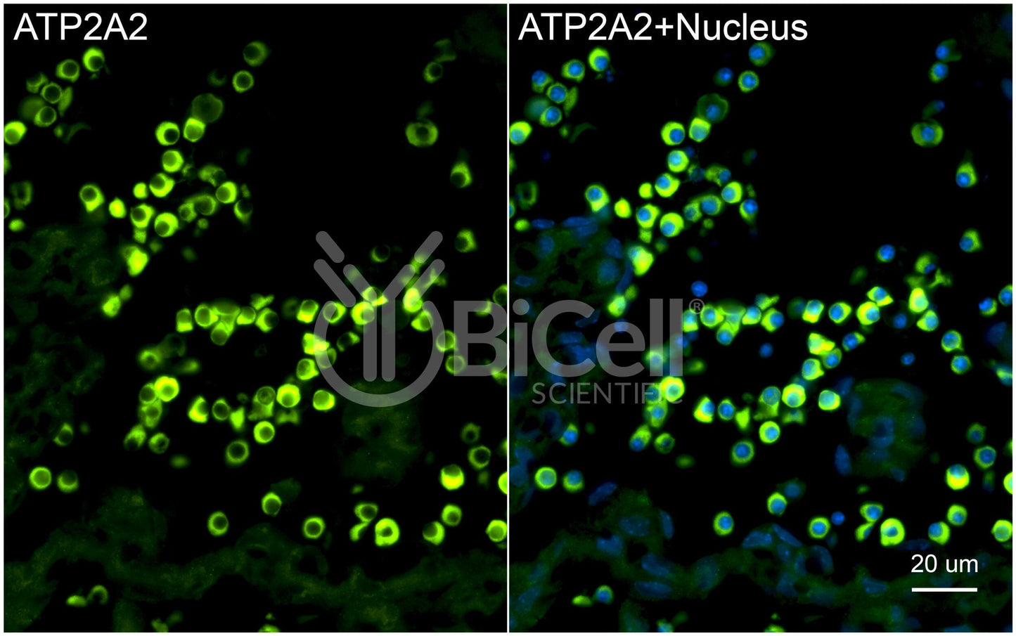 ATP2A2 (SERCA2) Antibody - FFPE Validated