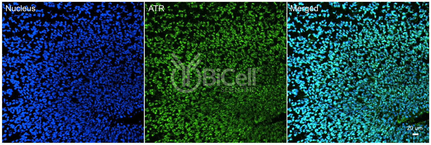 ATR Antibody - FFPE Validated
