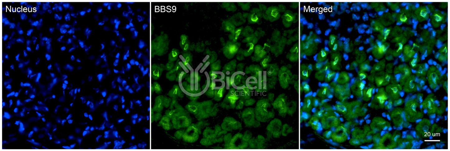 BBS9 (PTHB1) Antibody - Western Blot Validated