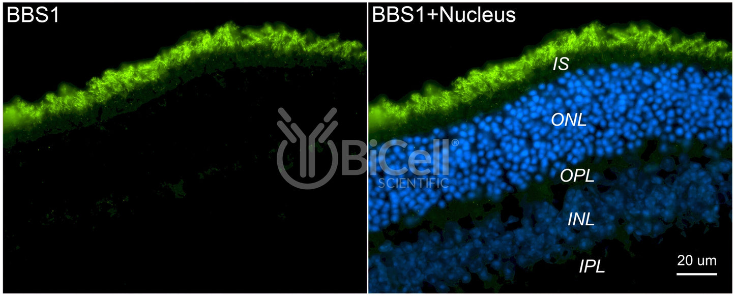 BBS1 Antibody (C-Terminus) - FFPE Validated