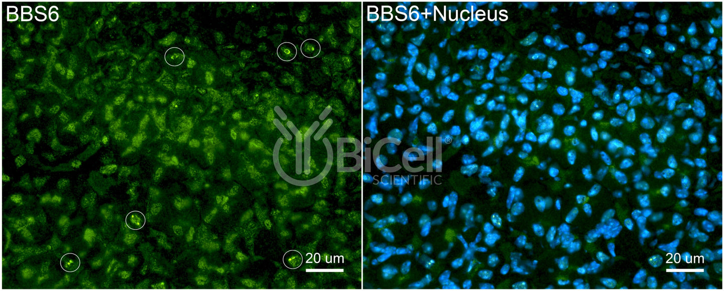 BBS6 Antibody - FFPE Validated