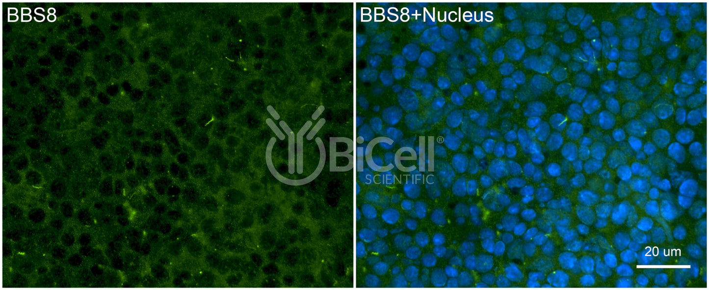 BBS8 (TTC8) Antibody - Western Blot Validated