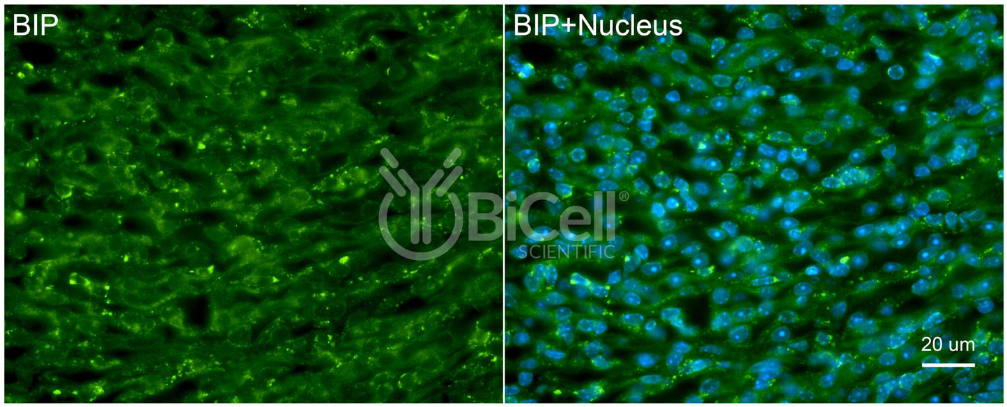 BIP (HSPA5 or GRP78) Antibody - FFPE Validated