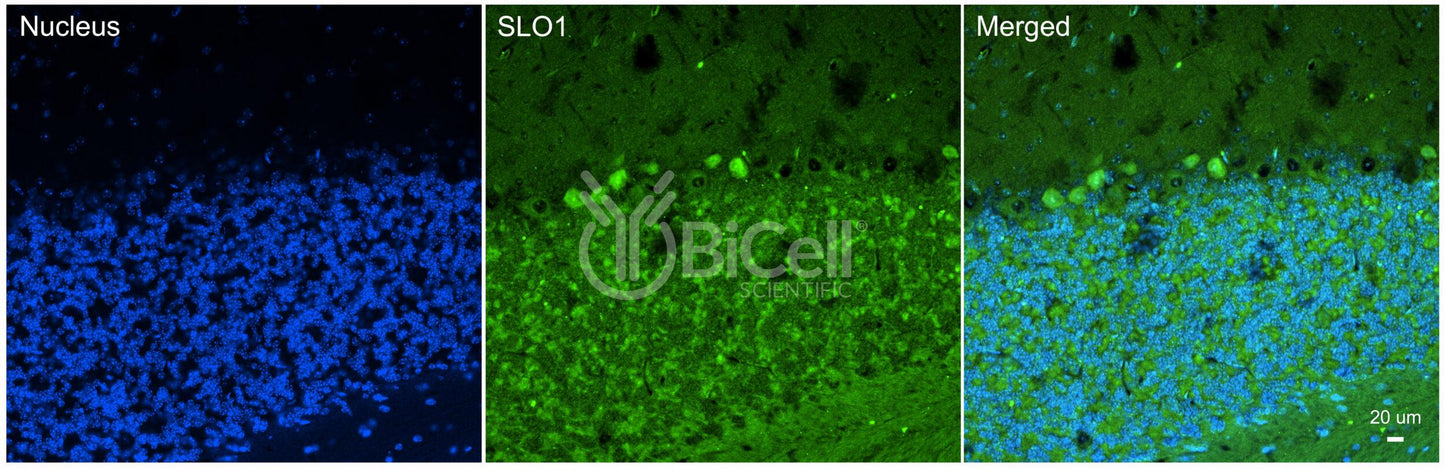 KCNMA1 (SLO1 or MaxiK or KCa1.1) Antibody - FFPE Validated
