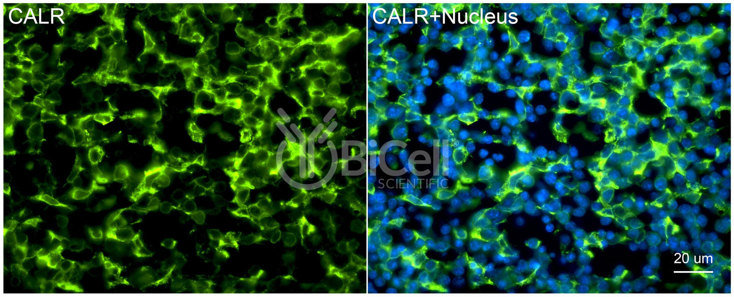 Calreticulin (CALR) Antibody