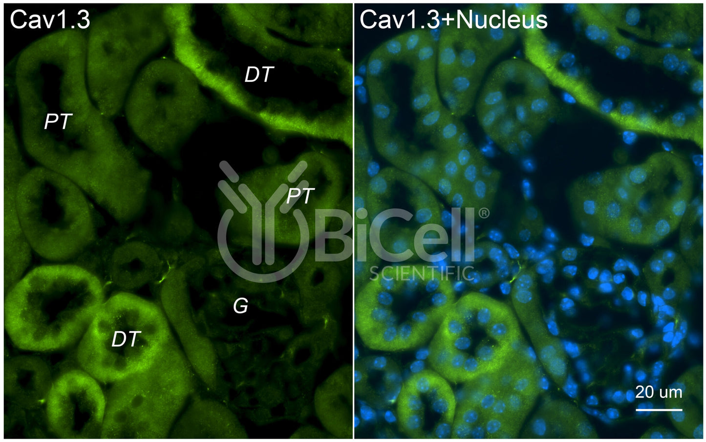 CACNA1D (Cav1.3) Antibody