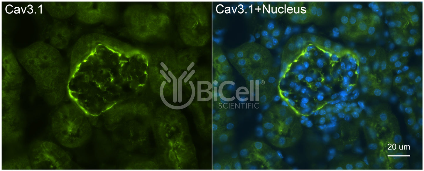 CACNA1G (Cav3.1) Antibody - Western Blot Validated