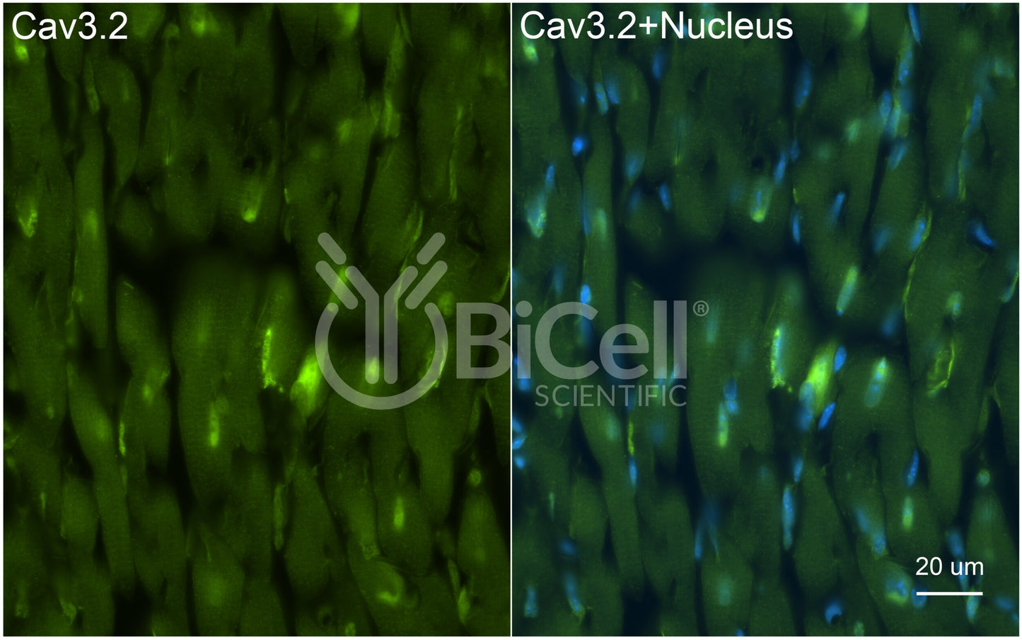 CACNA1H (Cav3.2) Antibody