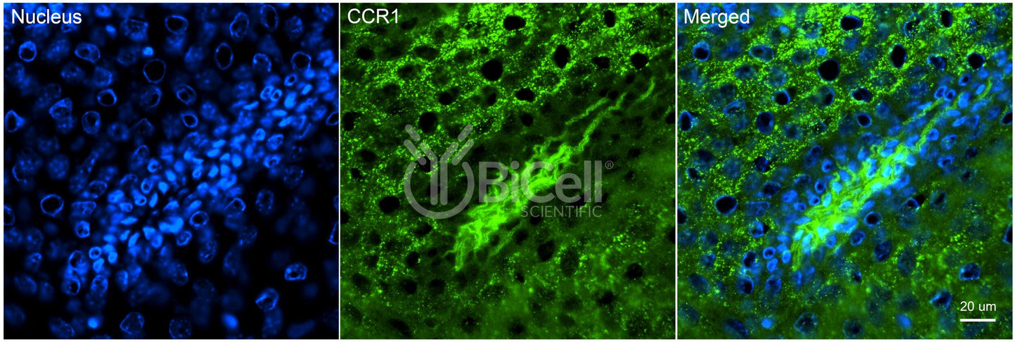 CCR1 (CD191) Antibody - FFPE Validated