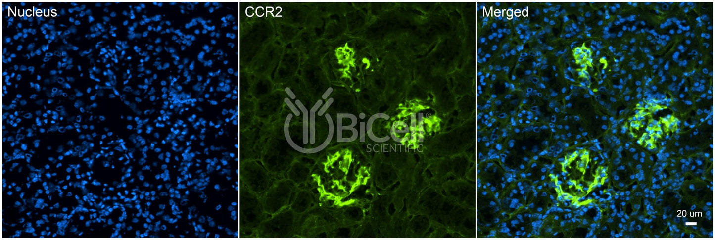 CCR2 (CD192) Antibody - Western Blot Validated