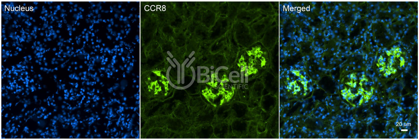 CCR8 (CDw198) Antibody - Western Blot Validated