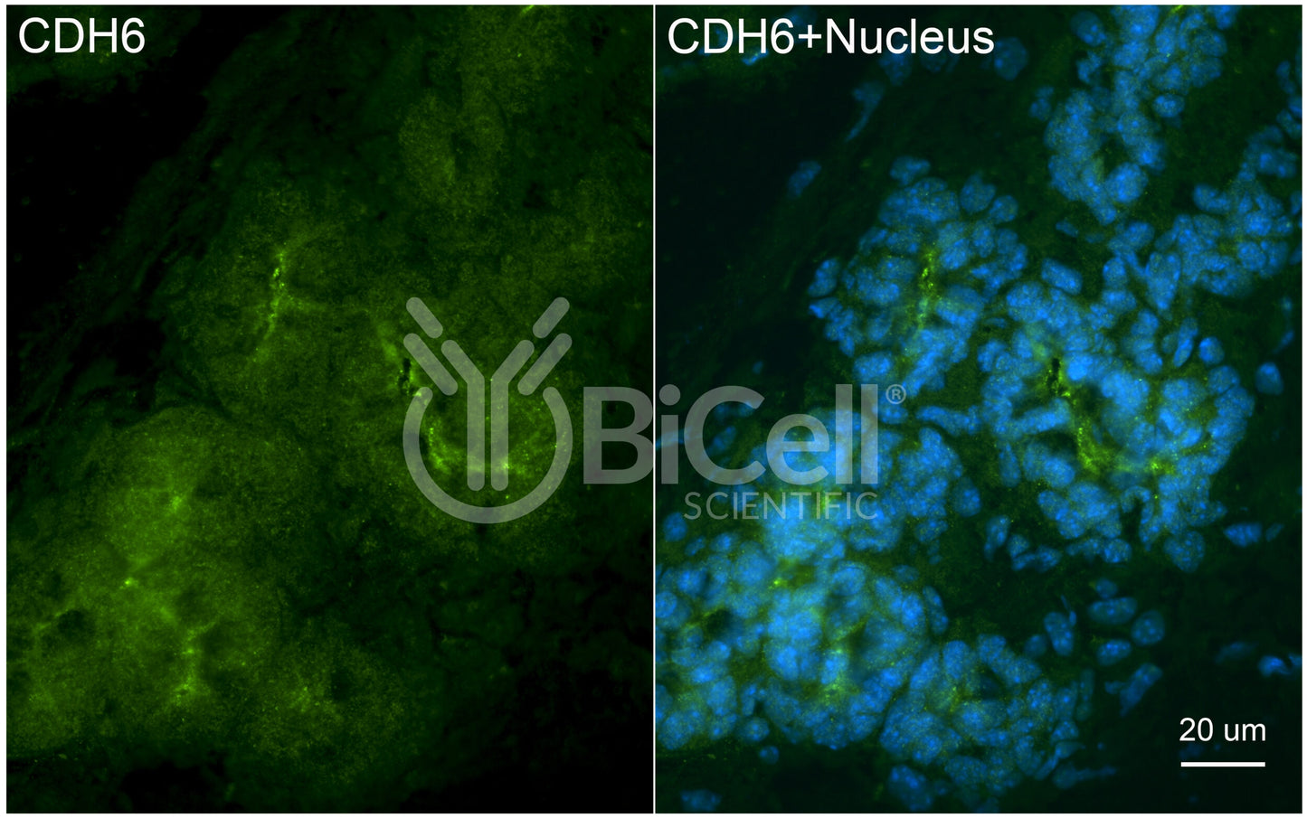 Cadherin-6 (CDH6) Antibody