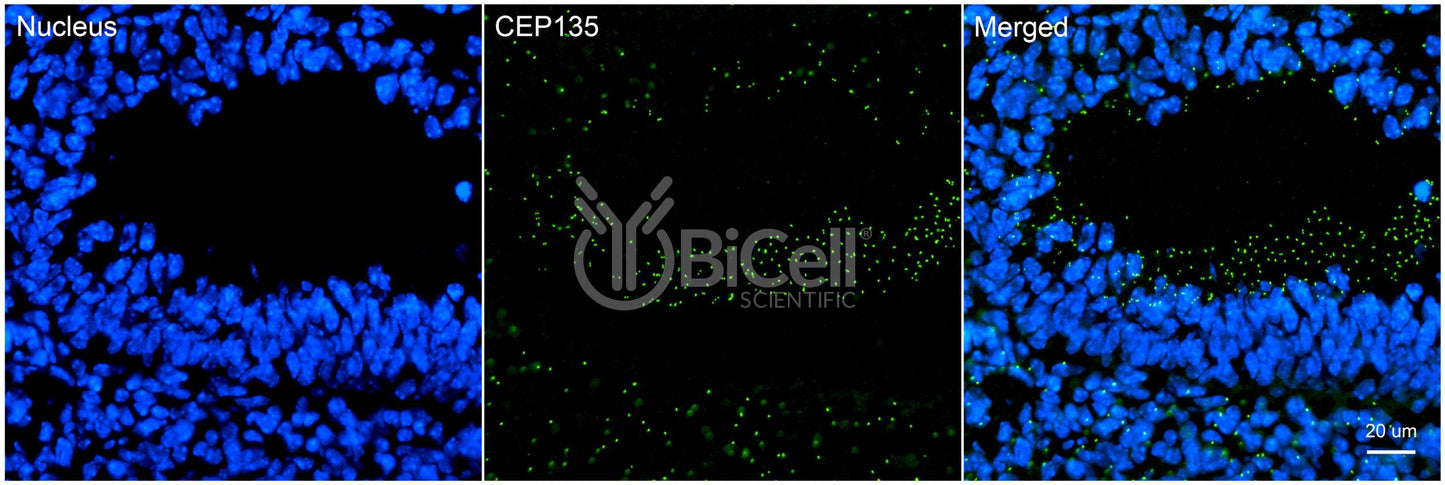 CEP135 (KIAA0635) Antibody - FFPE Validated