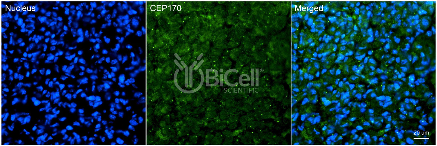 CEP170 (KIAA0470) Antibody