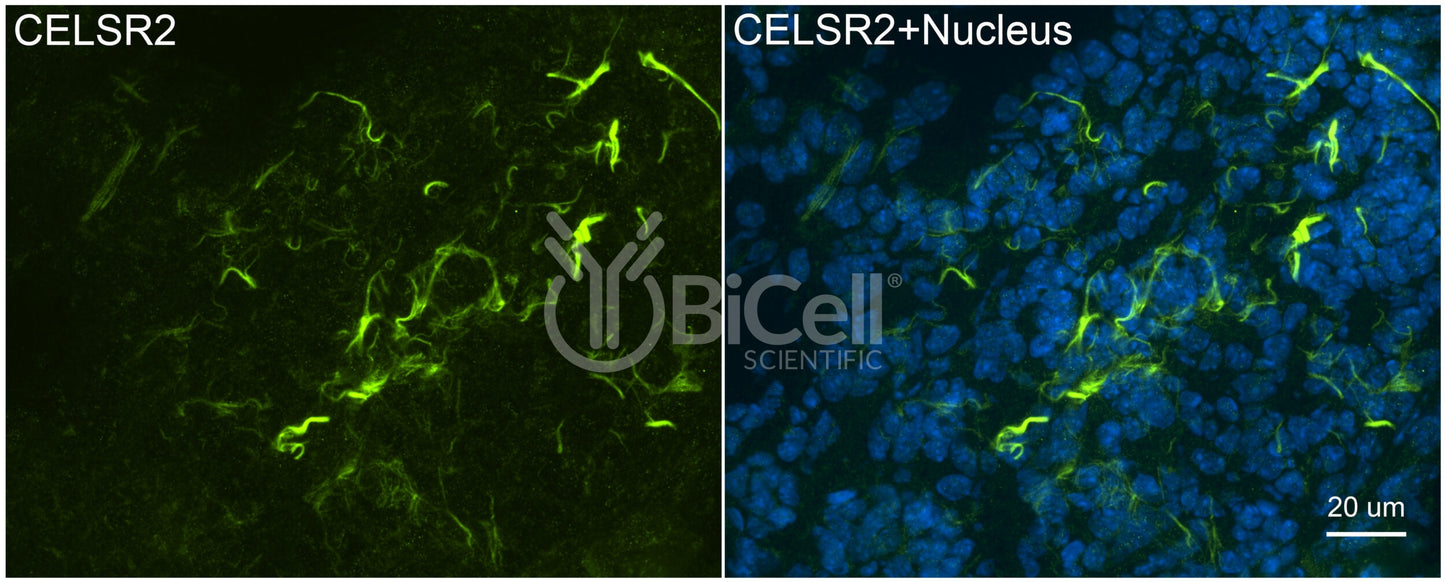 CELSR2 (CDHF10 or Flamingo1) Antibody